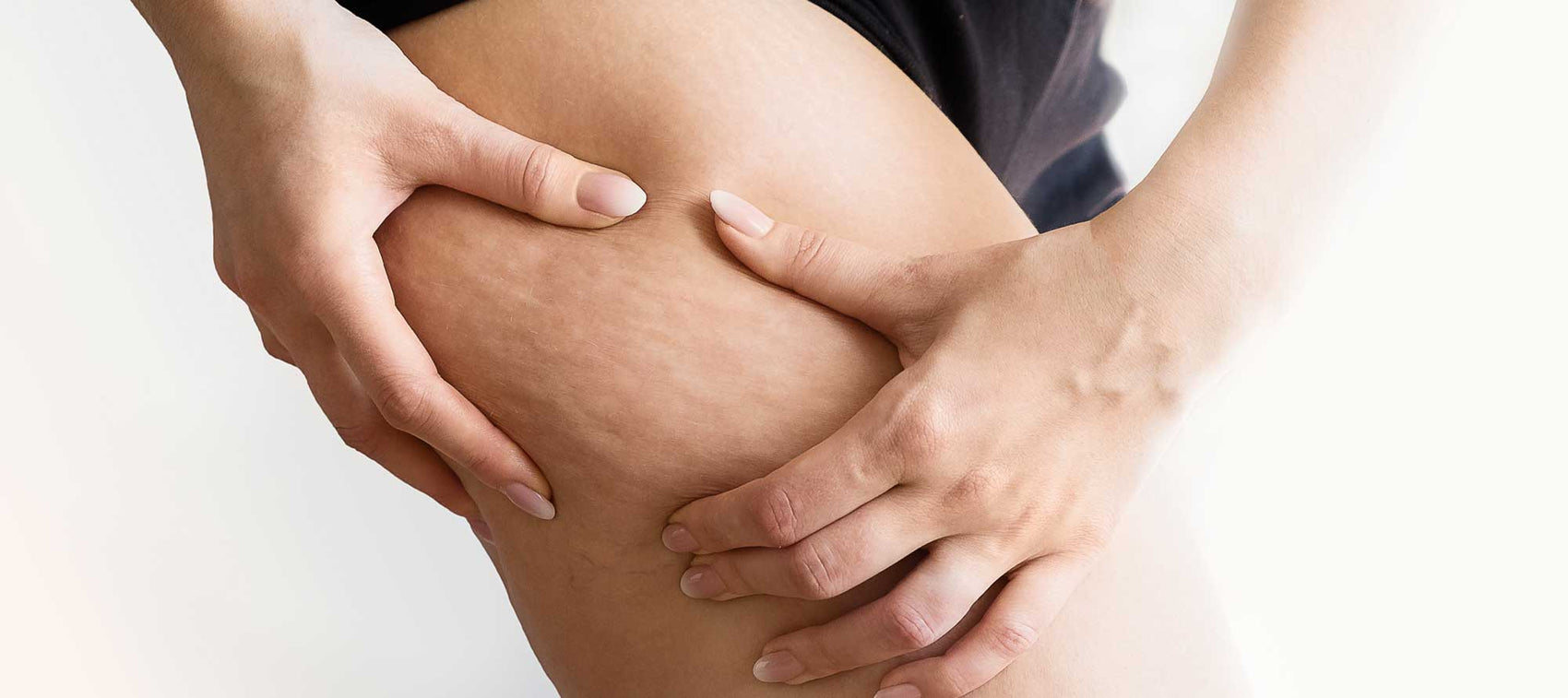 Bava di lumaca contro gli inestetismi della cellulite