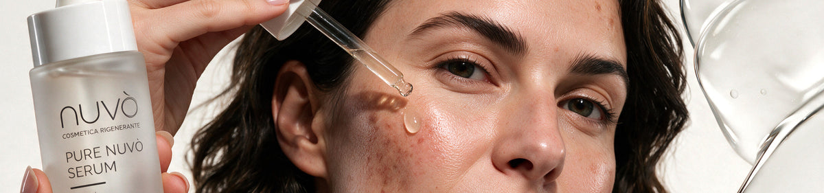Skin spots and blemishes